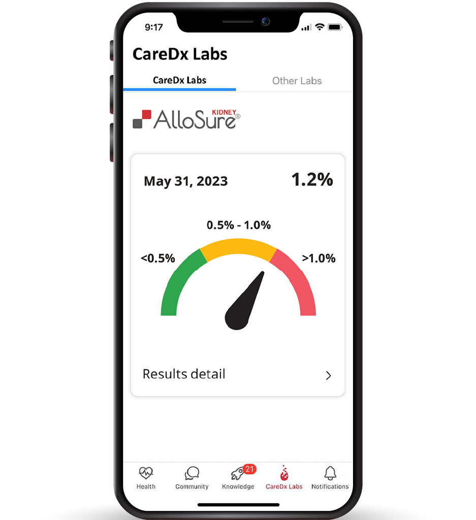 Access CareDx Test Results in AlloCare